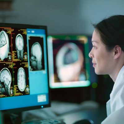 a-neurologist-looking-at-a-brain-scan-2